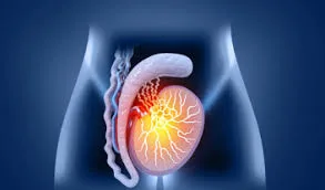 Prostanu suppelement3